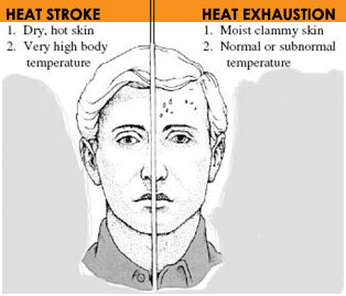 Heat stress symptoms