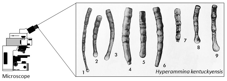 The microscopic agglutinated foraminifera Hyperammina kentuckyensis, shown at 50 times their size. From Conkin (1961, Plate 21, Figs. 1–9), used with permission of the Paleontological Research Institution.